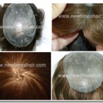 INS: Haarsystem mit in dünne Haut eingestochenem Haar